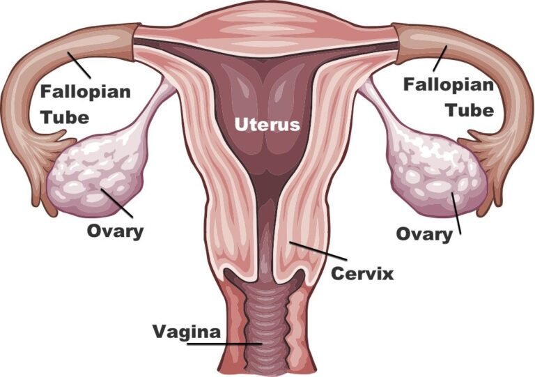 What Causes Ovarian Cysts and How to Treat Them