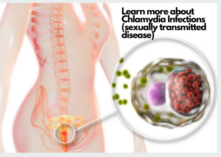 Chlamydia Infection (sexually transmitted disease): Meaning, Effects, Symptoms, Treatment