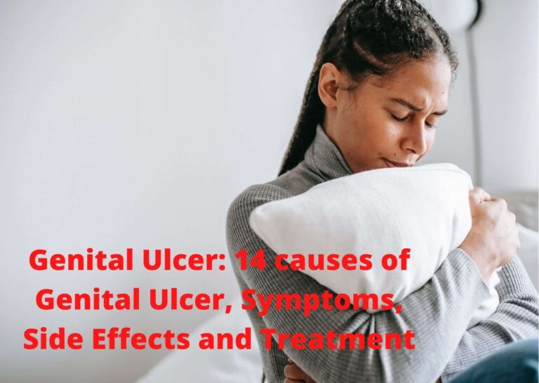 Genital Ulcer: 14 causes of Genital Ulcer, Symptoms, Side Effects and Treatment