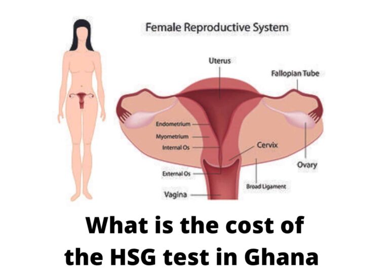 HSG test